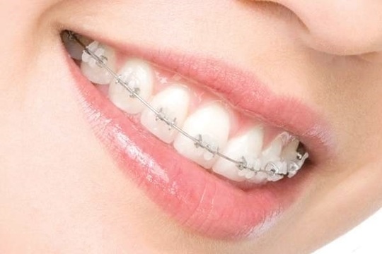矯正歯科・小児矯正ページ - 四條畷なんこう通り歯科